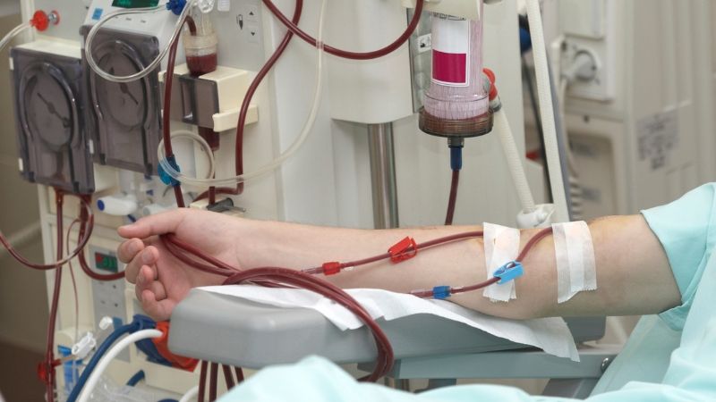 Kidney Patients on Dialysis During COVID-19