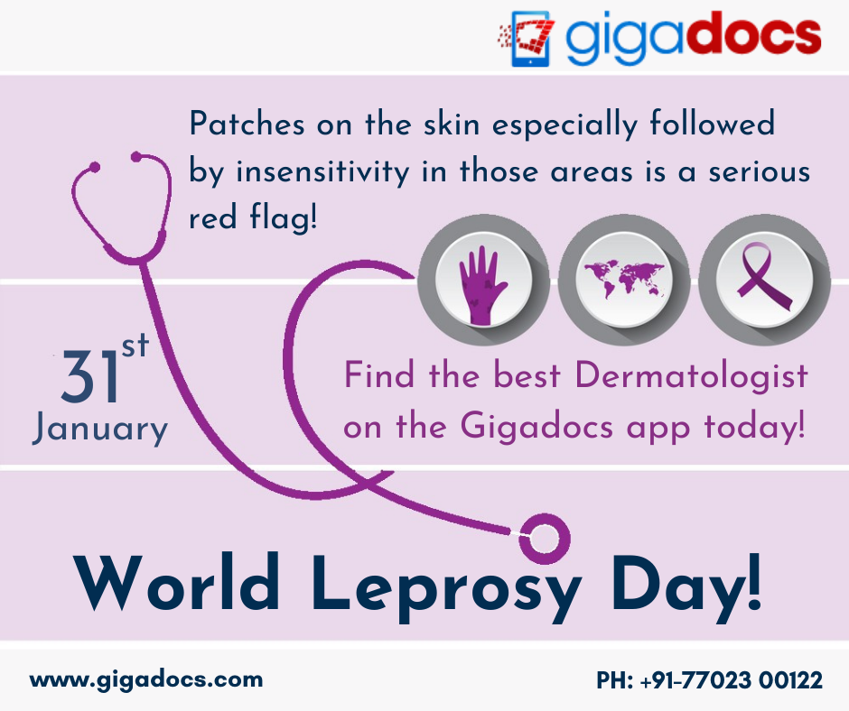 World Leprosy Day- Leprosy Symptoms, Diagnosis and Treatment