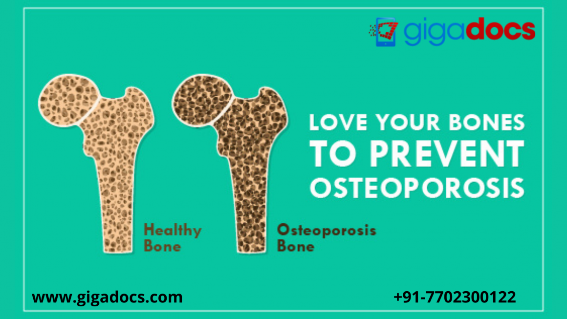 World Osteoporosis Day: Signs of Osteoporosis, Vitamins for Bones, and Bone-Strengthening Tips