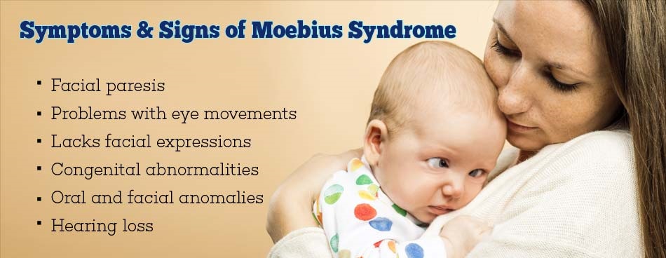 Moebius Syndrome Awareness Day: Causes, Symptoms, Diagnosis, and Treatment of the Moebius Syndrome