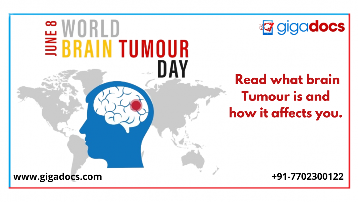 World Brain Tumor Day: Brain Cancer vs. Brain Tumor is there a difference?