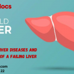 Types of Liver Diseases and Symptoms of a Failing Liver